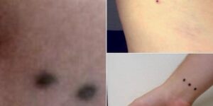 The ‘three-dot tattoo’ – potential meaning and significance