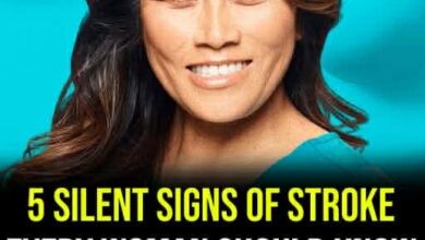 5 stroke signs every woman should know after Dr. Pimple Popper star suffers stroke while filming