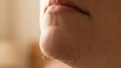 Chin Hair in Women: Why It Happens and How to Manage It Confidently