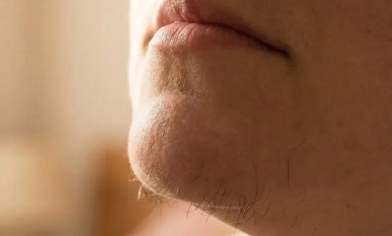 Chin Hair in Women: Why It Happens and How to Manage It Confidently