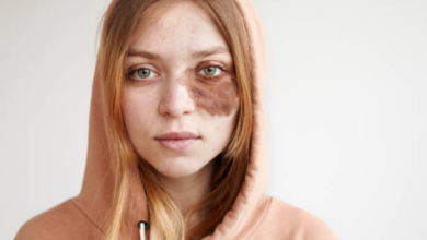 A Girl Mocked My Daughter’s Birthmark in Front of the Whole School—Then One Boy Took the Microphone