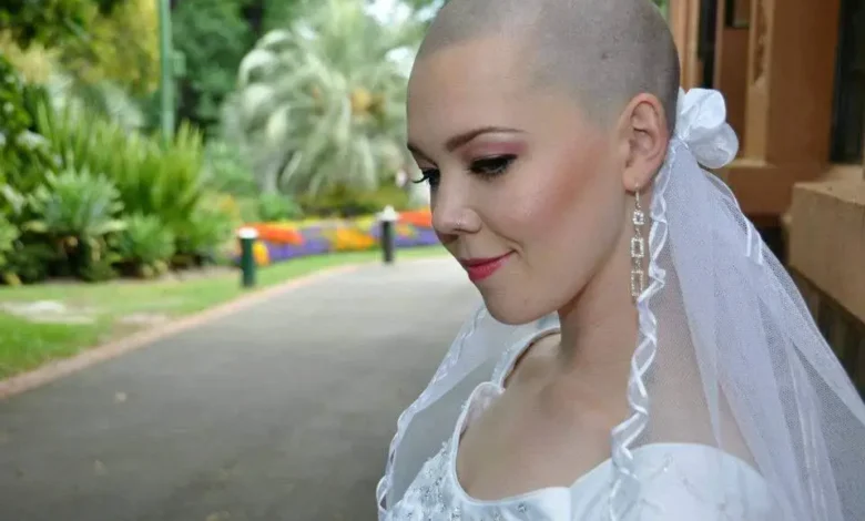 My Mother Ripped Off My Wig During My Wedding Vows — Then My Groom Took the Microphone My Mother Ripped Off My Wig During My Wedding Vows — Then My Groom Took the Microphone